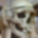 Skull of Burke, Edinburgh